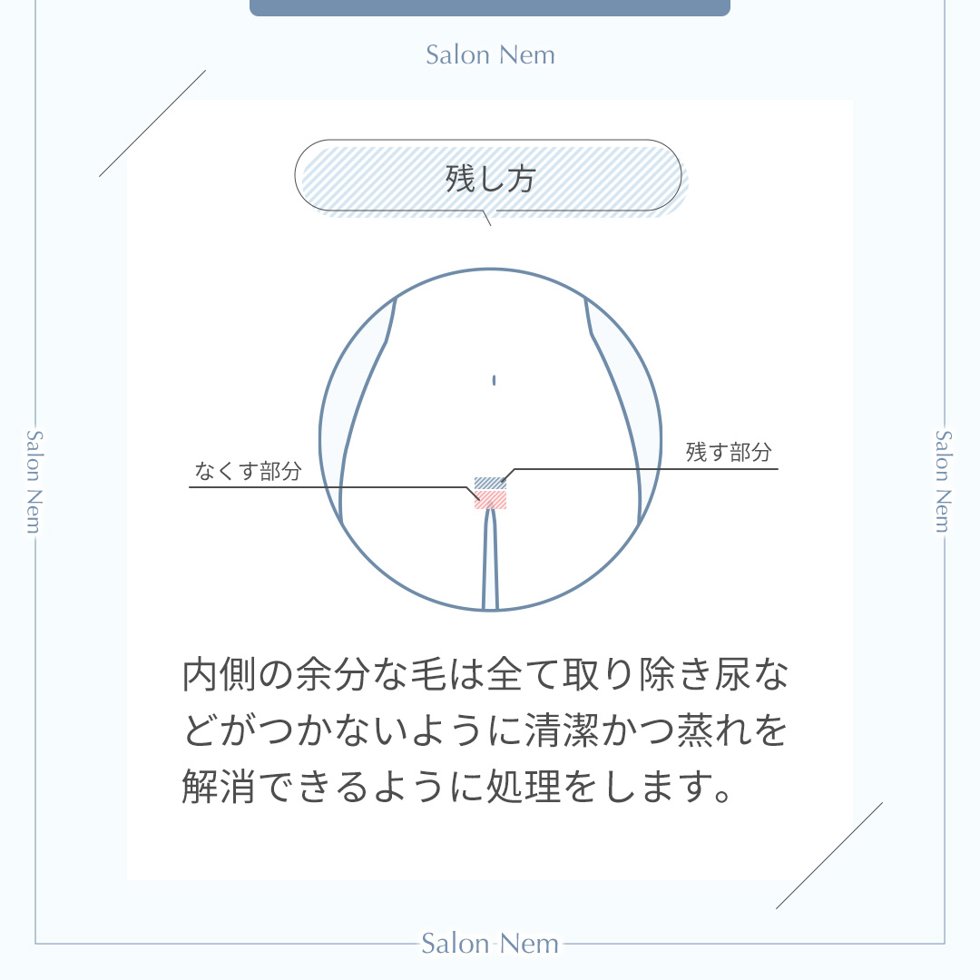図解