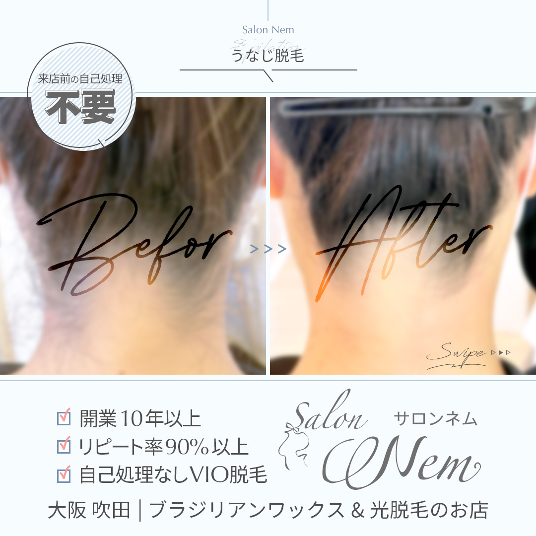 デリケートゾーンにおすすめアイテム紹介のイメージ画像