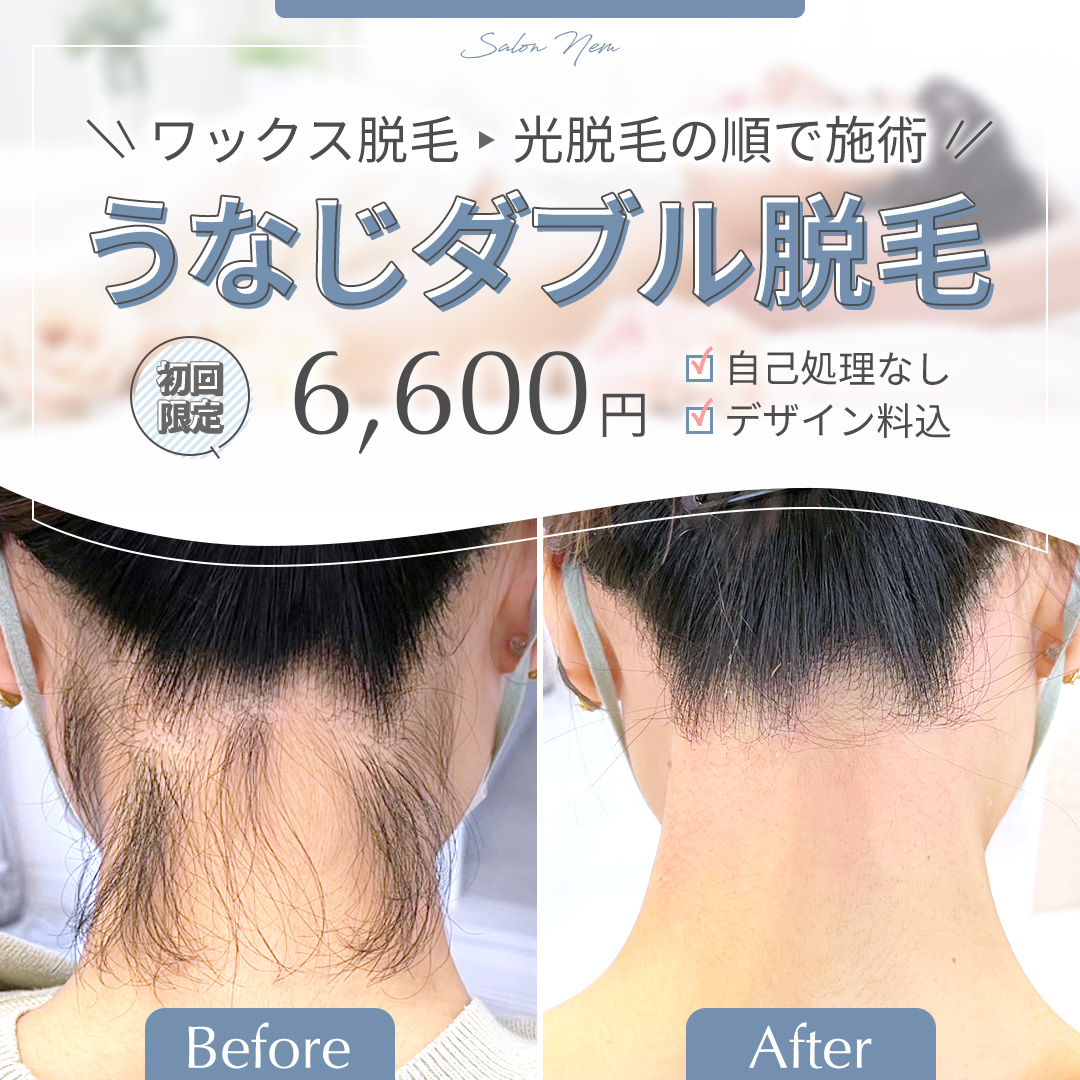 生えグセが気になる方にオススメ