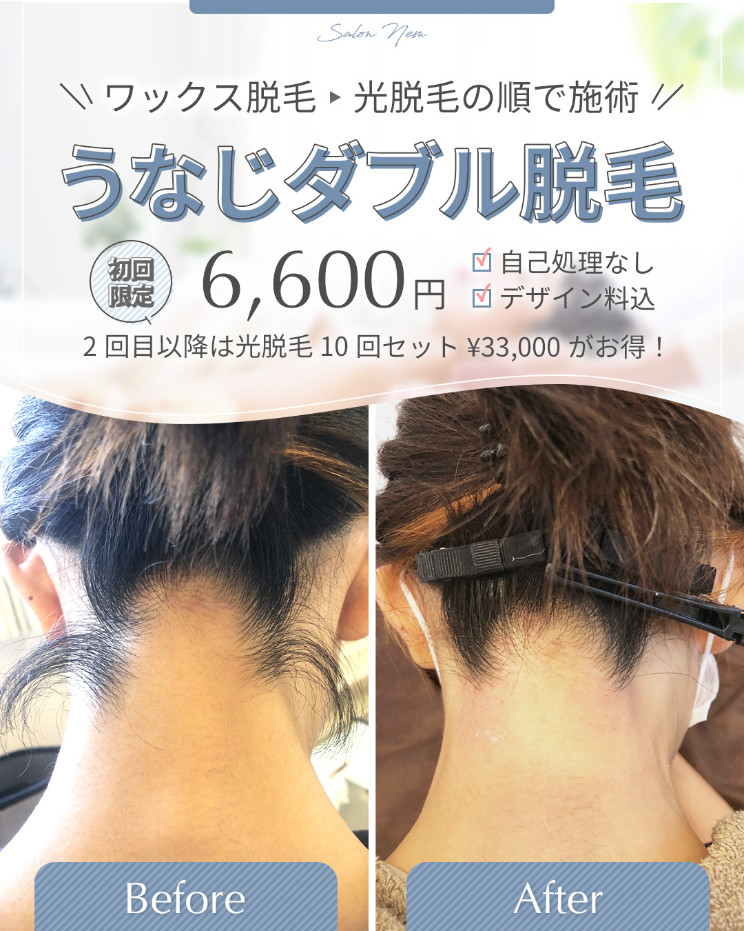 うなじ脱毛ビフォー・アフター